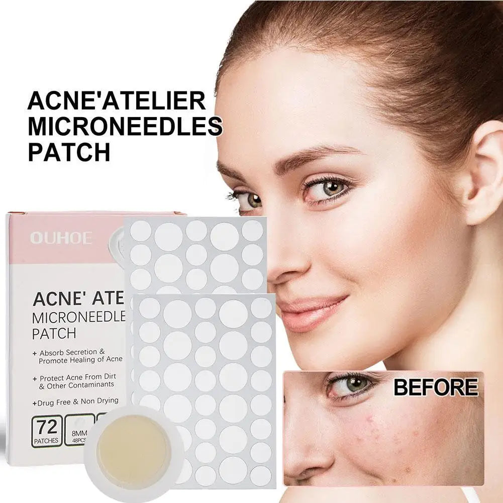 72pcs Acne Patches – Invisible Spot & Blemish Treatment